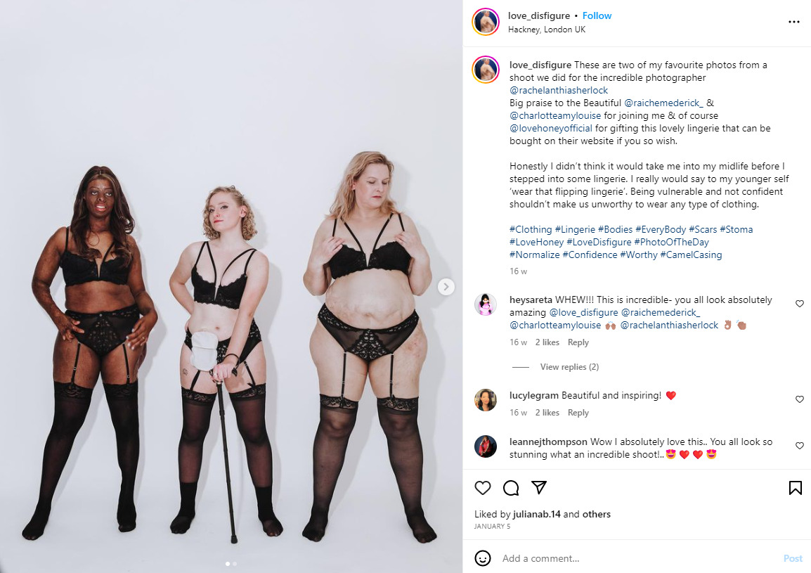 A campaign shot for LoveHoney, where people with body differences are celebrating themselves, and showing how beautiful they are, in spite of being different.