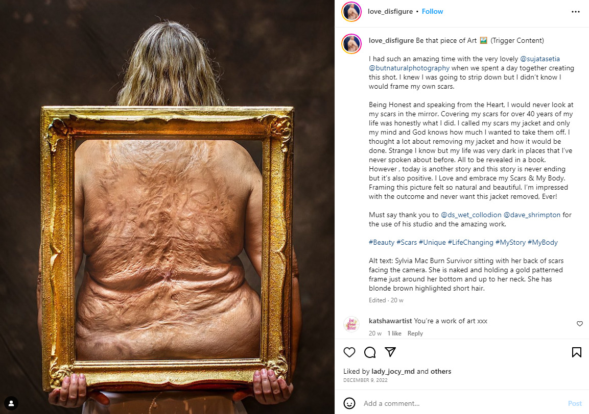 love_disfigure influencer session