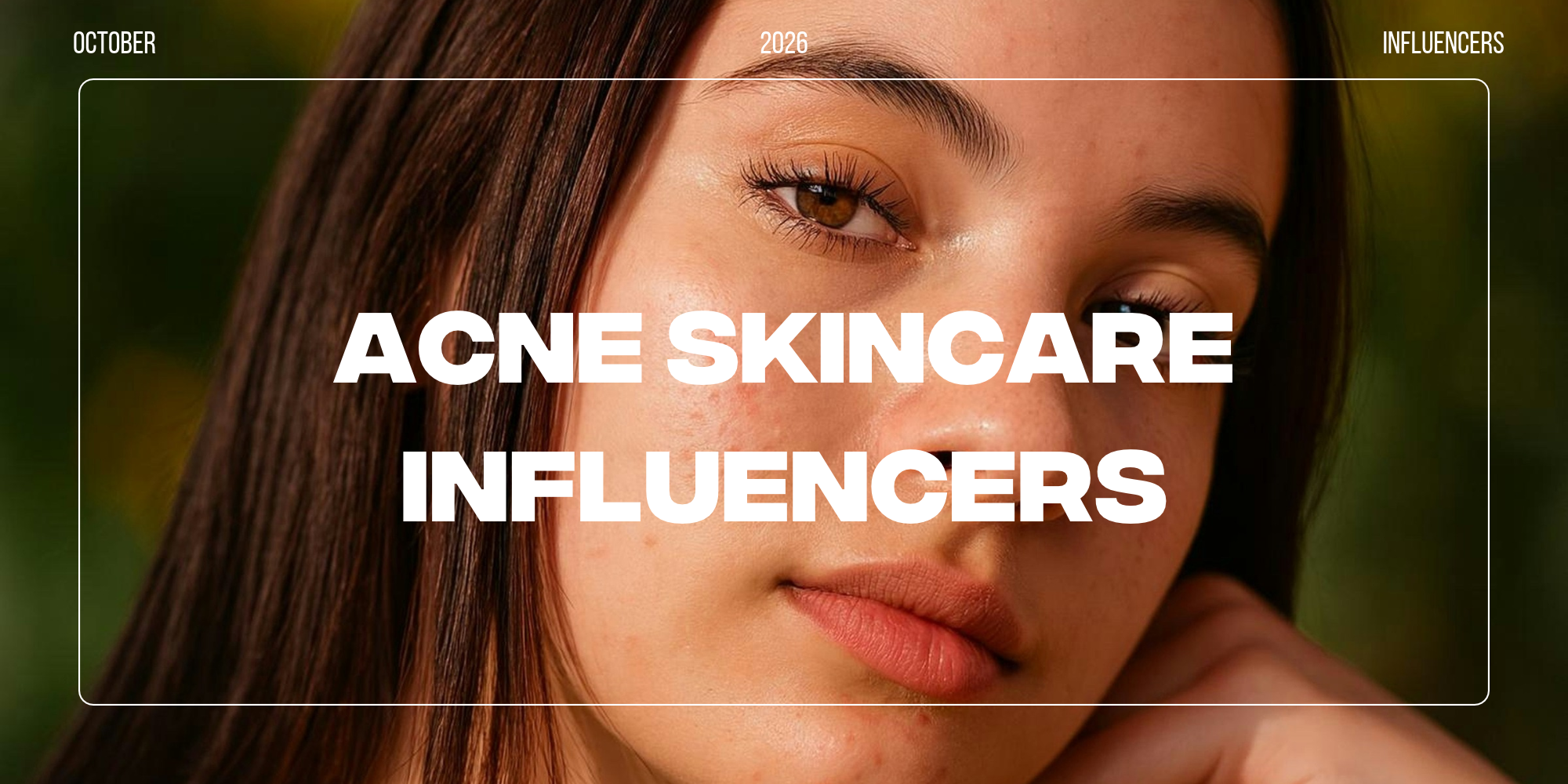 Acne skincare influencers featured image